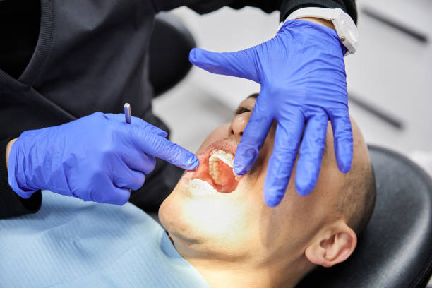 Best Urgent Tooth Repair  in Glendale, OH